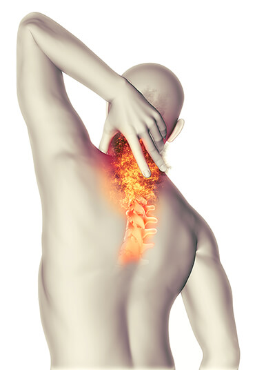 Rückenschmerzen durch eine Therapie & Schmerztherapie beim Radiologen entgegenwirken